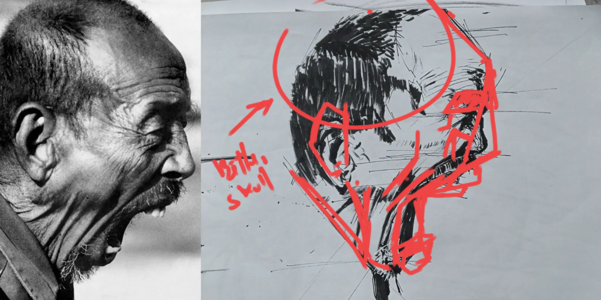 Observational study